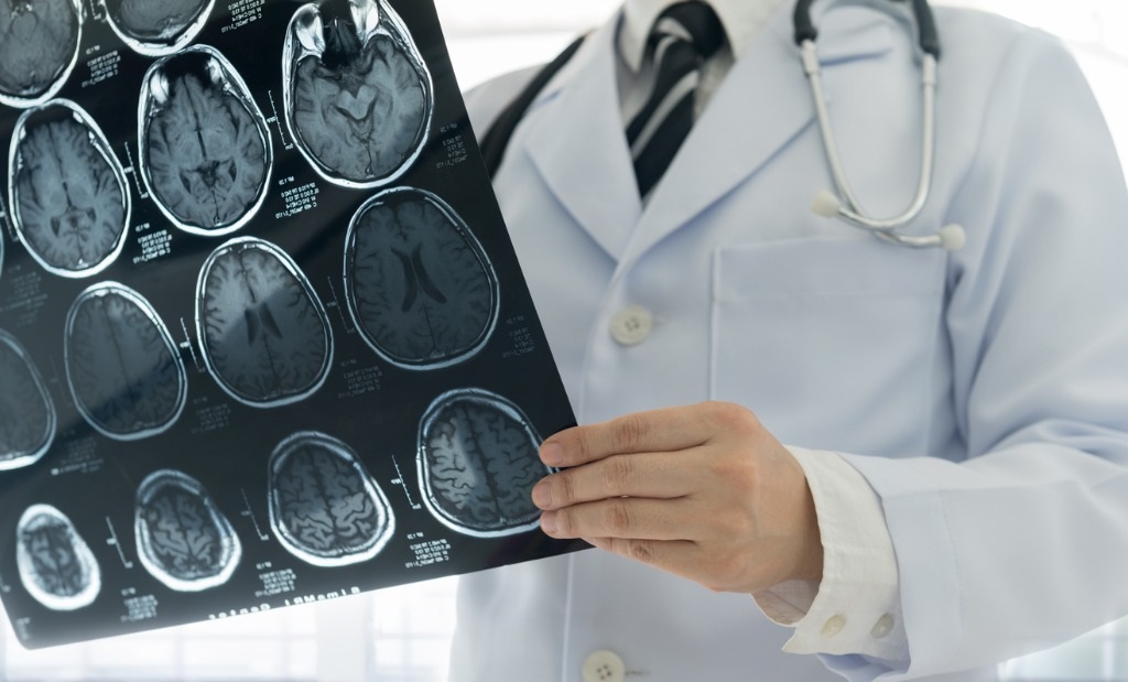 Health Policy Journal Club: Under-Utilizing CT Scans in Brain Injury